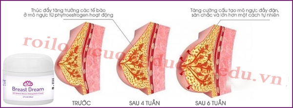 kem-nang-nguc-upsize6